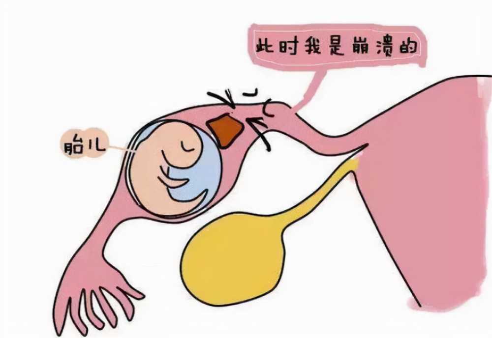 台州供卵生子助孕,中山供卵生子助孕