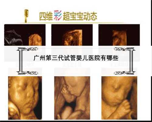 广州第三代试管婴儿医院有哪些